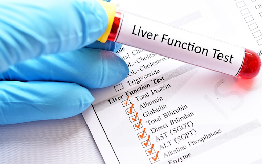 Liver Function Tests (LFT)
