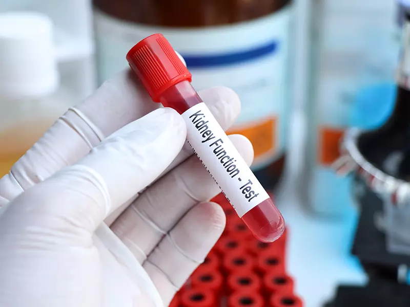 Kidney Function Tests (KFT)